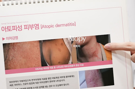 생기한의원이 안내하는 아토피 세정 습관 점검 방법